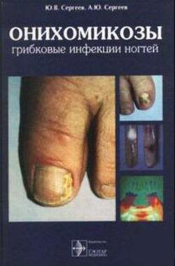 Онихомикозы. Грибковые инфекции ногтей. Сергеев Ю.В., Сергеев А.Ю.