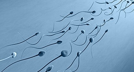 Спермограмма – это лабораторное исследование спермы (эякулята)
