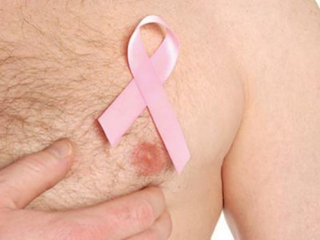 Рак груди у мужчин возможен