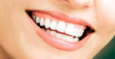 Реставрация зубов: показания и методы