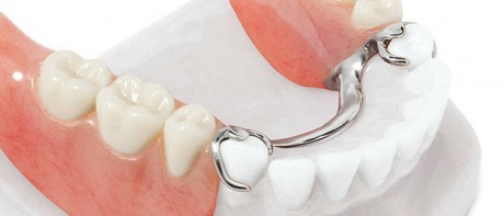 Протезирование зубов с естественным эффектом