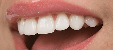 Эстетическая стоматология – красота Ваших зубов надолго!