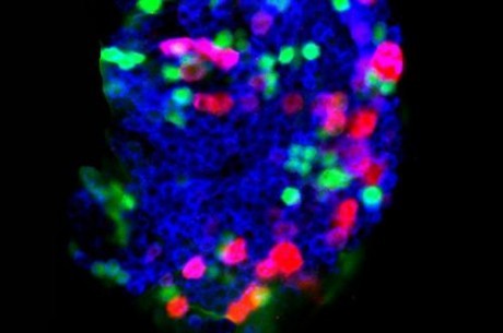Лос-Анджелесе исследователи обнаружили, что гены Scalloped (на фото) и Yorkie  играют ключевую роль в активации прогениторных клеток  для борьбы с инфекцией.