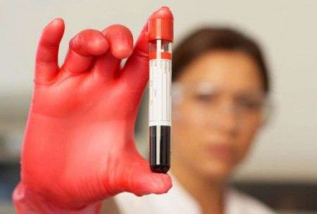 Исследователи говорят, что анализ крови может заменить биопсию для диагностики некоторых видов рака.