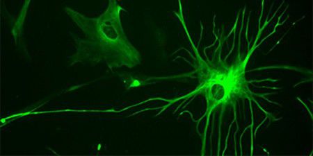 Астроциты помогают нейронам восстанавливаться