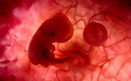 Патология на ранних стадиях беременности на дает уверенности в рождении ребенка с аномалиями